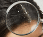 1 scalp analysis