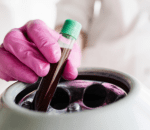 3 prp preparation