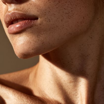 Benign skin growths