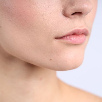 Dry & Dehydrated Skin