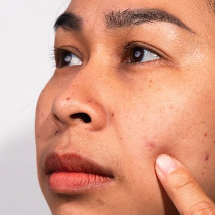 Dull & Tired Skin
