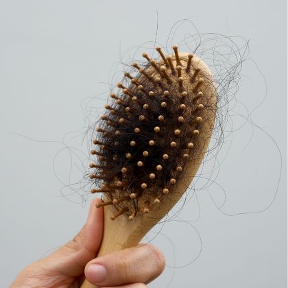 Excessive hair fall
