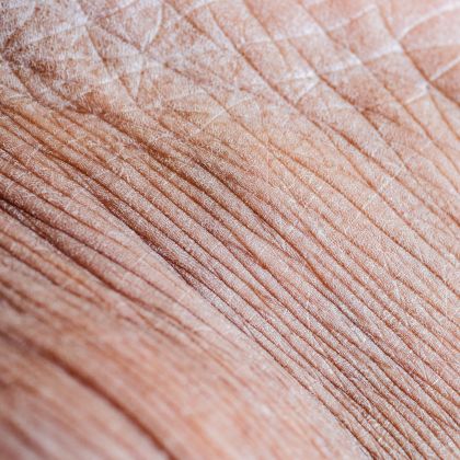 Fine Lines Wrinkles