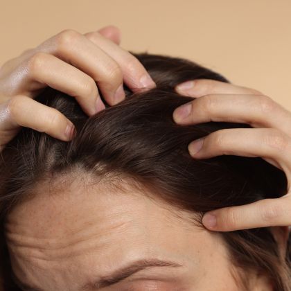 Hair thinning