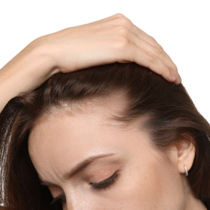 Poor hair density