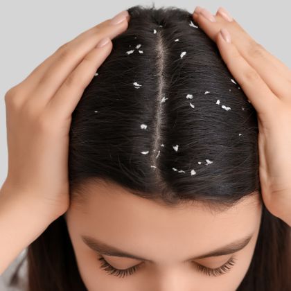 Scalp irritation