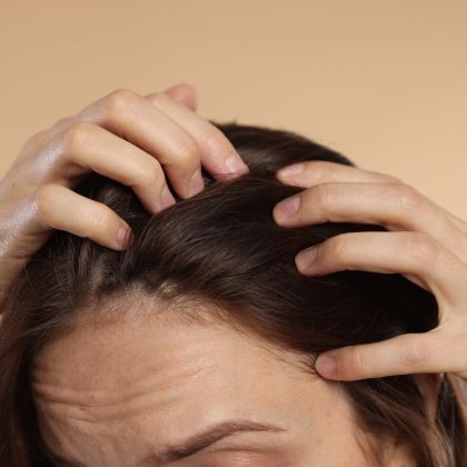Stress-related hair loss
