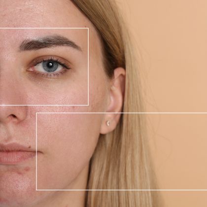 Uneven facial contours