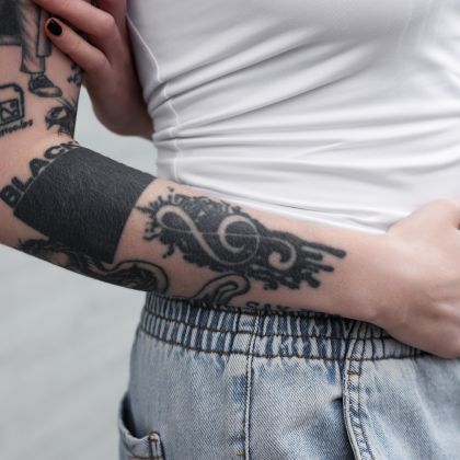 Unwanted tattoos