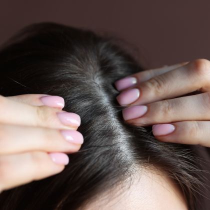 Weak hair roots 1