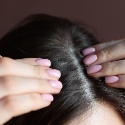 Weak hair roots