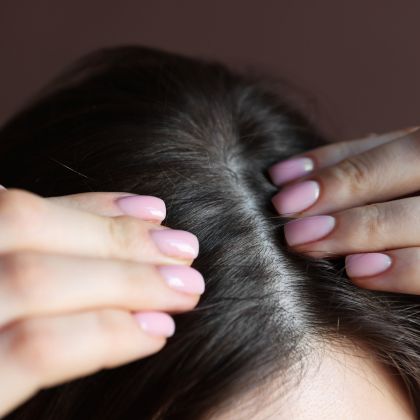 Weak hair roots