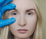 atep 1_ skin analysis