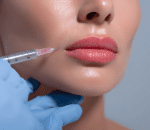botox or filler application