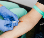 step 2 blood collection