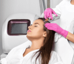 step 3 prp preparation