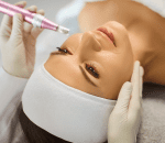 step 4_ suction renewal