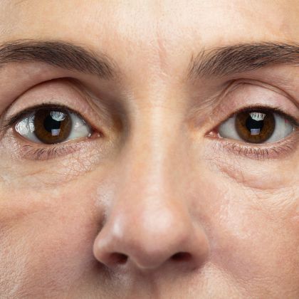Dull Tired Skin