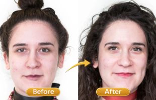 medi facials