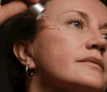 serum infusion