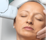 Step 4_ Collagen