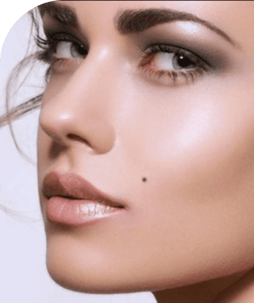 Subtle enhansment2